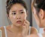 Skincare for Oily Skin