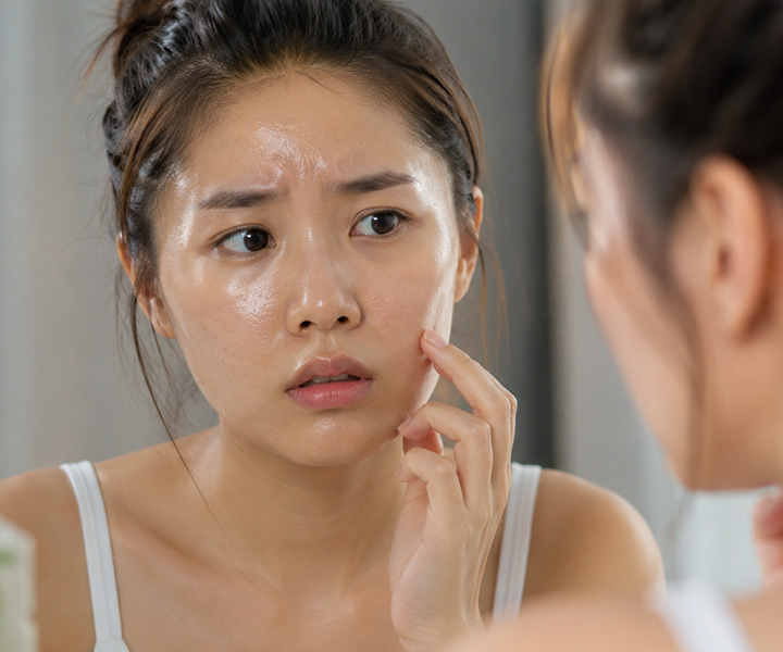 Skincare for Oily Skin
